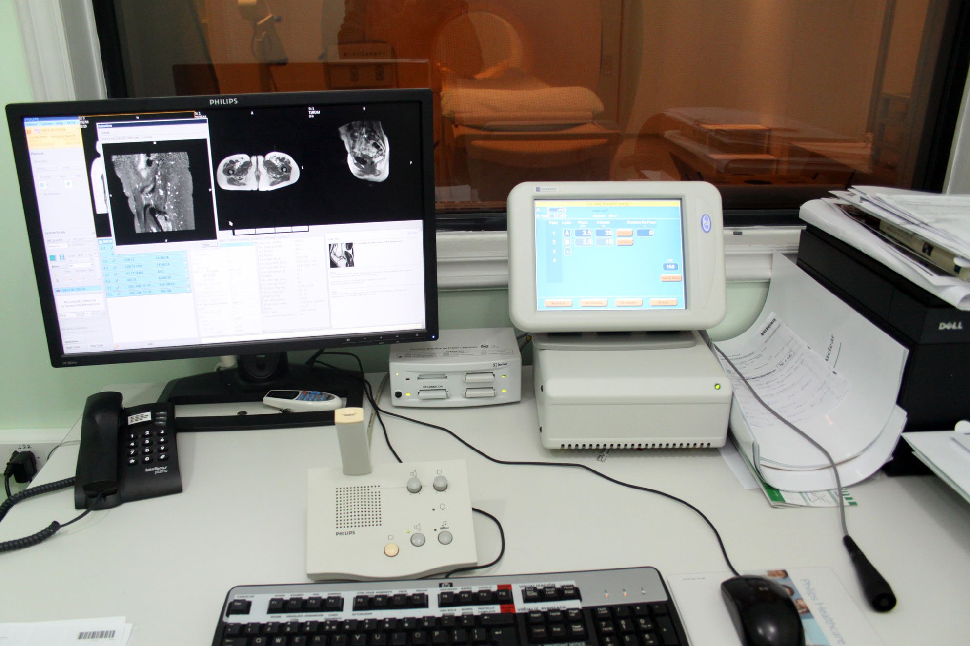 computador da tomografia